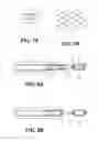 Fig. 07 - Medical implant having a curlable matrix structure and method of use