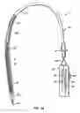 Fig. 02 - Methods and apparatus for endovascularly replacing a patient's heart valve