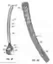Fig. 03 - Methods and apparatus for endovascularly replacing a patient's heart valve