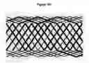 Fig. 17 - Methods and apparatus for endovascularly replacing a patient's heart valve