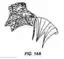 Fig. 23 - Methods and apparatus for endovascularly replacing a patient's heart valve