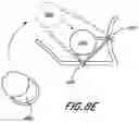 Fig. 13 - Two part 