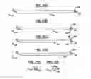 Fig. 07 - Articulating interbody spacer, vertebral body replacement