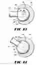 Fig. 07 - Containment system for constraining a prosthetic component