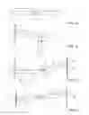 Fig. 02 - Surgical Grafts