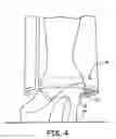 Fig. 05 - PANT LEG STABILIZER