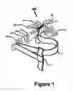 Fig. 02 - MULTIPLE PURPOSE STRAP-PACK SYSTEM