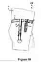 Fig. 11 - MULTIPLE PURPOSE STRAP-PACK SYSTEM