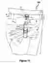 Fig. 14 - MULTIPLE PURPOSE STRAP-PACK SYSTEM