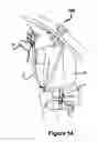 Fig. 15 - MULTIPLE PURPOSE STRAP-PACK SYSTEM