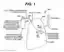 Fig. 02 - Variable resistance pulmonary ventilation bypass valve