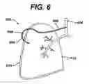 Fig. 05 - Variable resistance pulmonary ventilation bypass valve