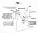 Fig. 02 - Variable resistance pulmonary ventilation bypass valve
