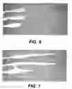 Fig. 06 - Methods for enhancing fracture conductivity in subterranean formations