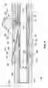 Fig. 07 - Expandable reamers for earth boring applications
