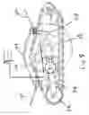 Fig. 09 - Tracked vehicle