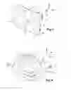 Fig. 04 - Arrangement for surface mounting an electrical component by soldering, and electrical component for such an arrangement