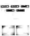 Fig. 08 - MICRO FILTRATION DEVICE FOR SEPARATING BLOOD PLASMA AND FABRICATION METHOD THEREFOR