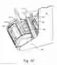Fig. 24 - Automated tissue dispenser