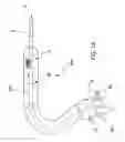 Fig. 02 - Stapling and cutting in resectioning for full thickness resection devices