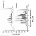 Fig. 35 - Systems for differential ion mobility analysis