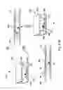 Fig. 89 - Radioimaging using low dose isotope