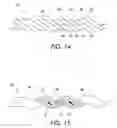 Fig. 09 - Magnetic resonance imaging interference immune device