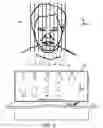 Fig. 04 - Thick-slice display of medical images