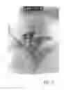 Fig. 24 - Multiple metal oxide submicron particles