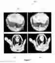 Fig. 08 - Compositions And Methods For Enhancing Contrast In Imaging