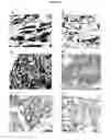 Fig. 09 - Cytotoxicity mediation of cells evidencing surface expression of TROP-2