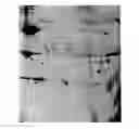 Fig. 01 - Campylobacter Jejuni Outer Membrane Protein Immunogenic Composition