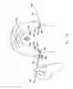 Fig. 09 - LAMINATED SURGICAL TAPE AND METHOD FOR USING SAME