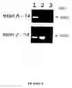 Fig. 06 - Variants of alpha-fetoprotein coding and expression sequences