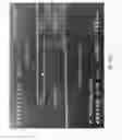 Fig. 16 - ULTRA-THIN SOI VERTICAL BIPOLAR TRANSISTORS WITH AN INVERSION COLLECTOR ON THIN-BURIED OXIDE (BOX) FOR LOW SUBSTRATE-BIAS OPERATION AND METHODS THEREOF