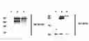 Fig. 01 - Novel Goodpasture Antigen-Binding Protein Isoforms and Protein Misfolded-Mediated Disorders