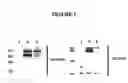 Fig. 02 - Novel Goodpasture Antigen-Binding Protein Isoforms and Protein Misfolded-Mediated Disorders