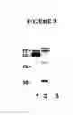 Fig. 04 - Novel Goodpasture Antigen-Binding Protein Isoforms and Protein Misfolded-Mediated Disorders