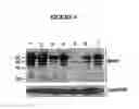 Fig. 05 - Novel Goodpasture Antigen-Binding Protein Isoforms and Protein Misfolded-Mediated Disorders