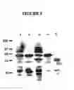 Fig. 06 - Novel Goodpasture Antigen-Binding Protein Isoforms and Protein Misfolded-Mediated Disorders
