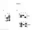 Fig. 07 - Novel Goodpasture Antigen-Binding Protein Isoforms and Protein Misfolded-Mediated Disorders