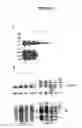 Fig. 09 - Novel Goodpasture Antigen-Binding Protein Isoforms and Protein Misfolded-Mediated Disorders