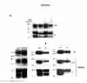 Fig. 10 - Novel Goodpasture Antigen-Binding Protein Isoforms and Protein Misfolded-Mediated Disorders