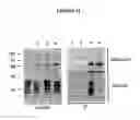 Fig. 12 - Novel Goodpasture Antigen-Binding Protein Isoforms and Protein Misfolded-Mediated Disorders