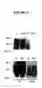 Fig. 13 - Novel Goodpasture Antigen-Binding Protein Isoforms and Protein Misfolded-Mediated Disorders
