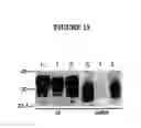 Fig. 14 - Novel Goodpasture Antigen-Binding Protein Isoforms and Protein Misfolded-Mediated Disorders