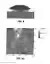 Fig. 08 - Bioadhesive for tissue repair