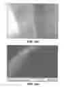 Fig. 12 - Bioadhesive for tissue repair