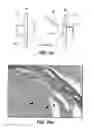 Fig. 16 - Bioadhesive for tissue repair