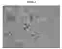 Fig. 06 - Methods and compositions for detecting amyotrophic lateral sclerosis
